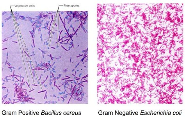 Are bacillus gram positive or negative?