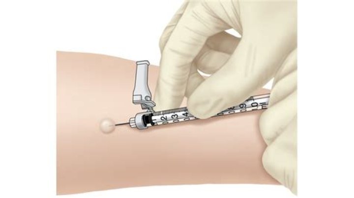 Are we immunized for tb?