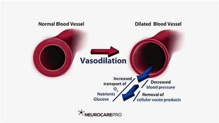 Can anxiety cause vasodilation?