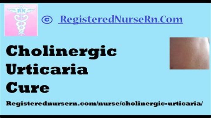 Can cholinergic urticaria be cured?