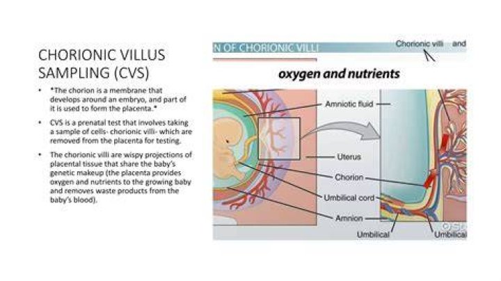 Can chorionic villus sampling tell gender?