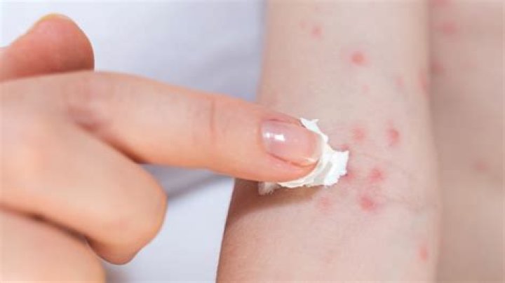 Can soaps cause rashes?