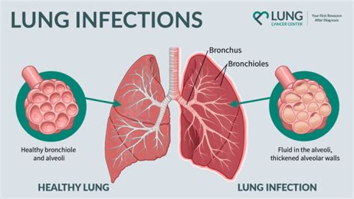 Can spice irritate the lungs?