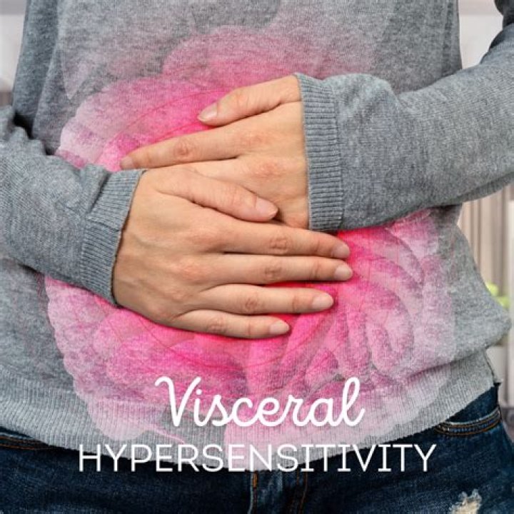 Can visceral hypersensitivity be cured?