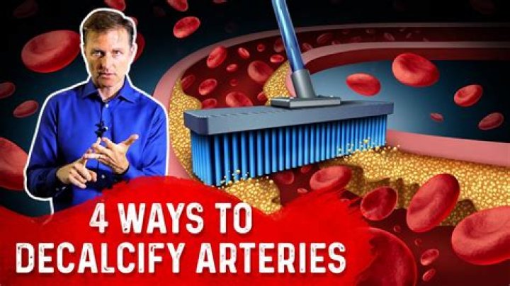 Can you decalcify arteries?