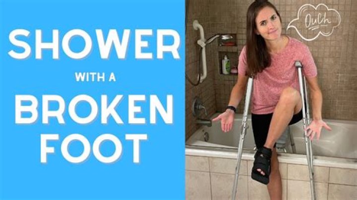 Can you shower with external fixator?