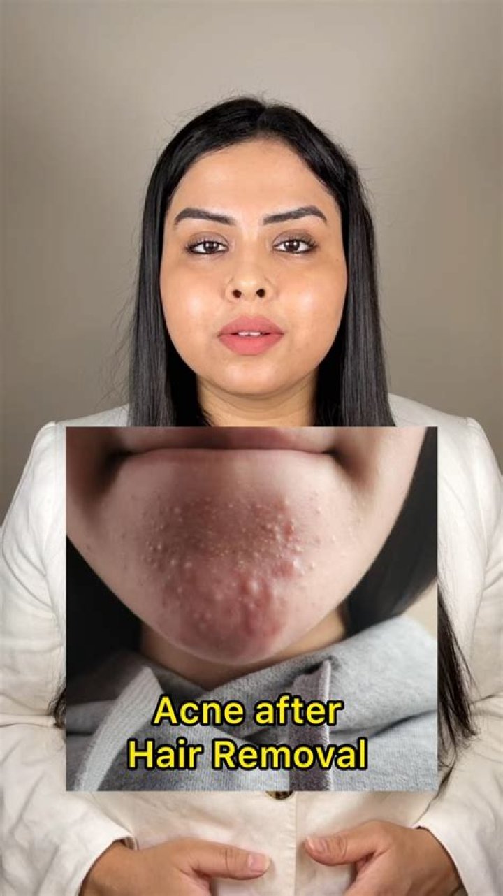 Did i get pimples after shaving?
