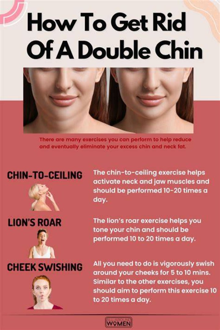 Do double chins go away?