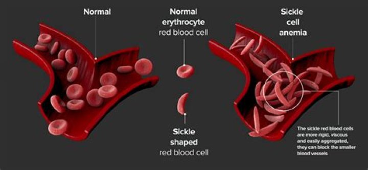 Do reticulocytes have hemoglobin?