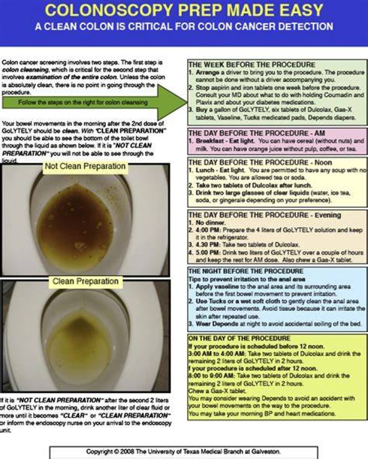 Do you need bowel prep for sigmoidoscopy?