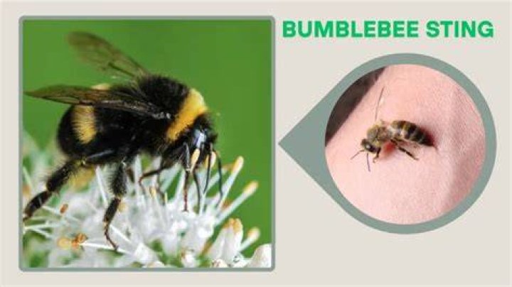 Does a bumblebee sting hurt?