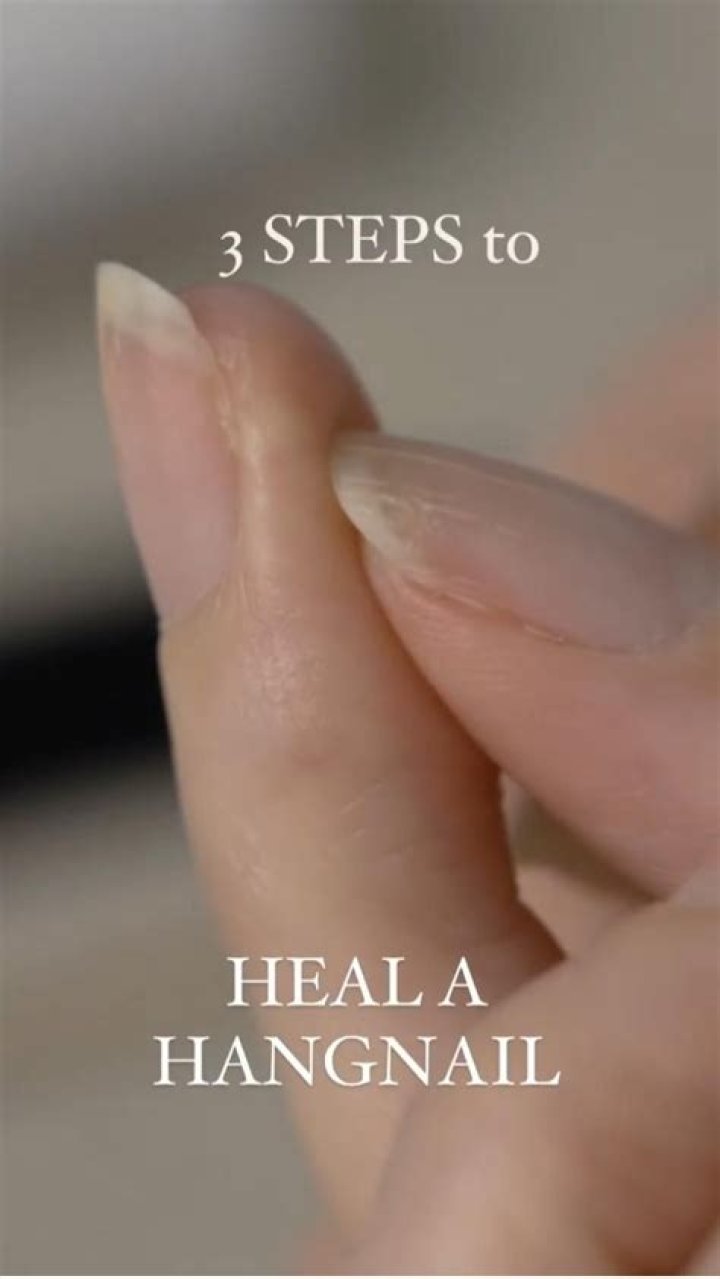Does a hangnail heal on its own?