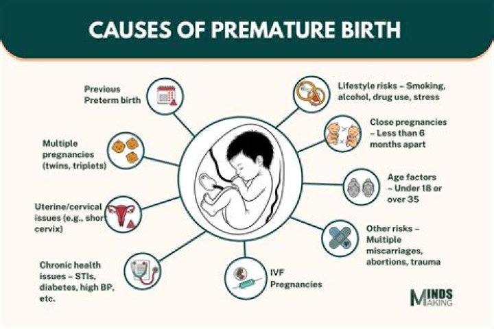 Does being premature affect milestones?