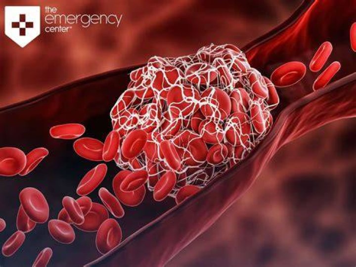 Does blood clots move?