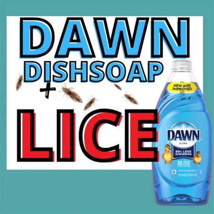 Does dawn kill lice?