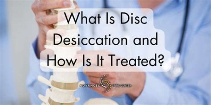 Does disc desiccation cause pain?