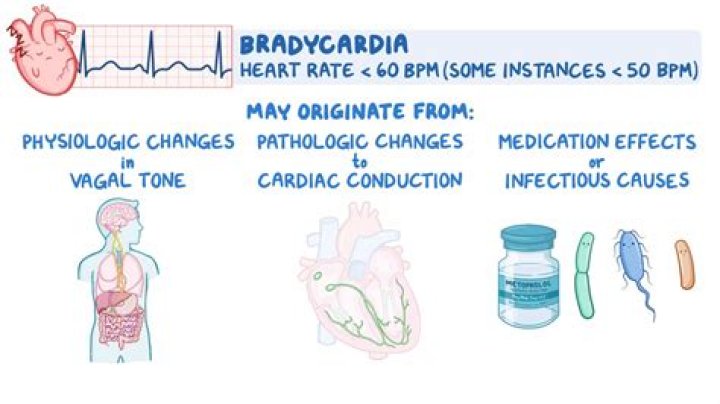 Does lisinopril cause bradycardia?
