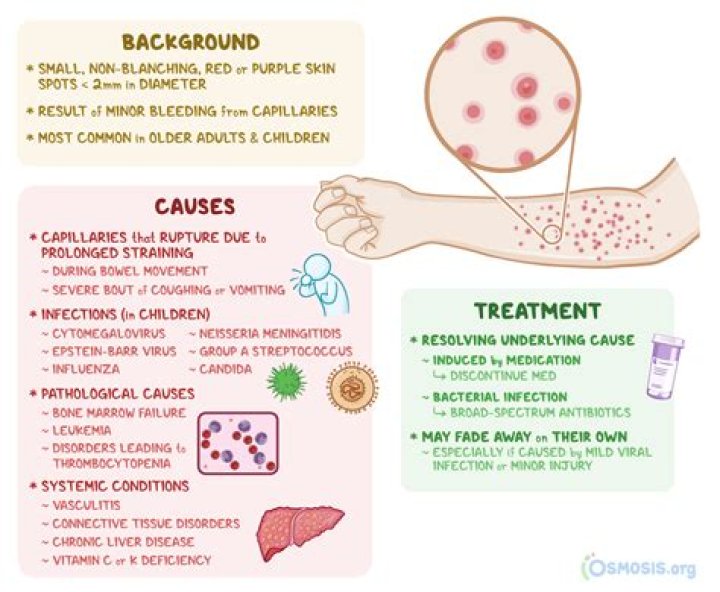 Does petechiae go away?