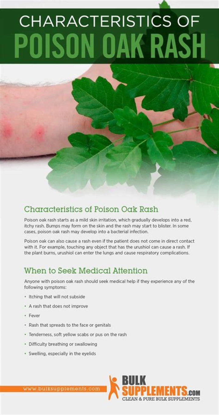 Does poison oak itch?