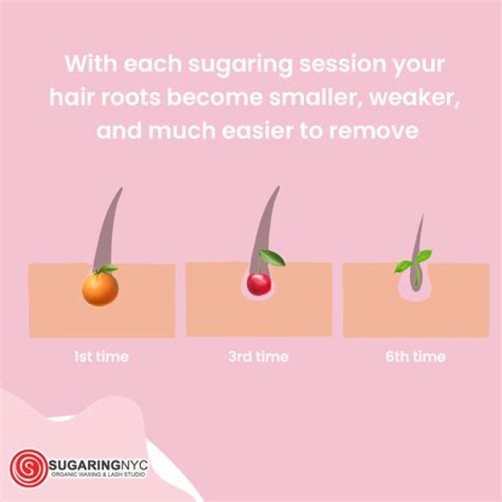 Does sugaring remove hair permanently?