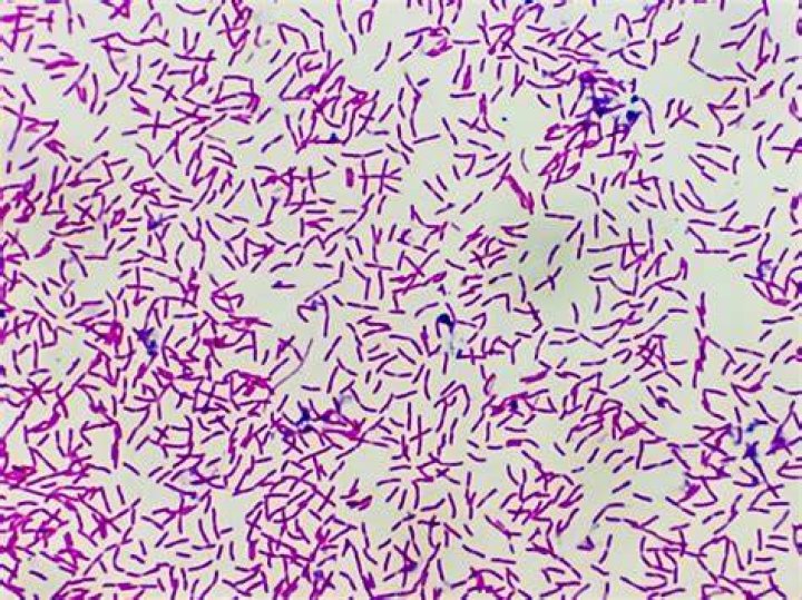Has a striped appearance when viewed under the microscope?