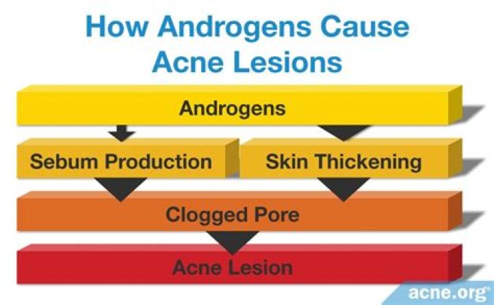 How do androgens cause acne?