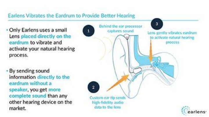 How does earlens work?