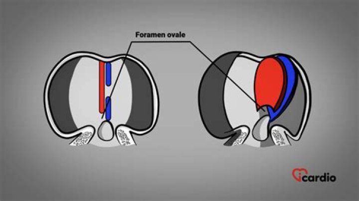 How does foramen ovale work?