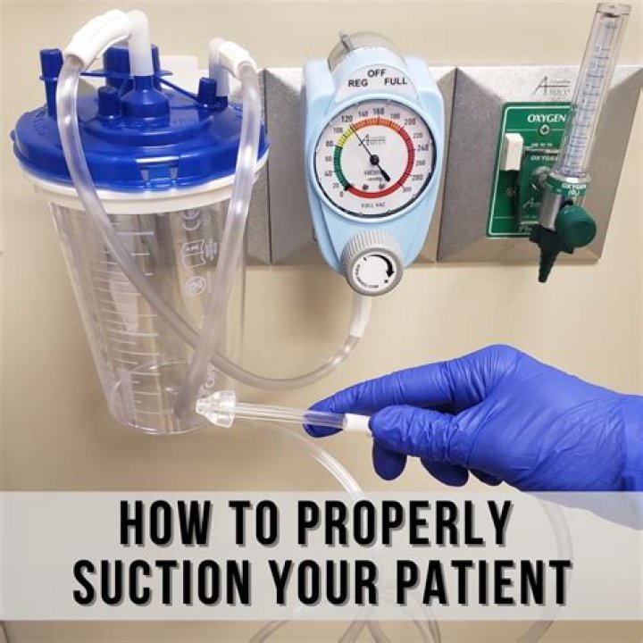 How does the suction work?