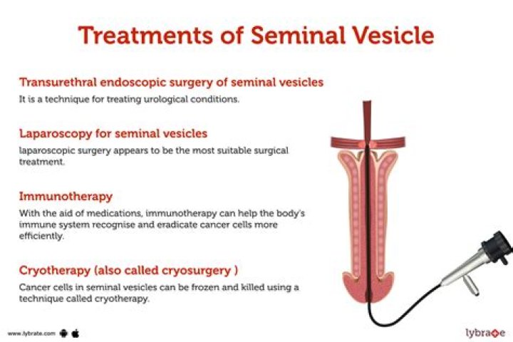 How long does seminal vesiculitis last?