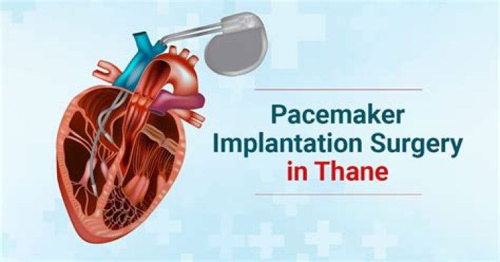 How pacemaker surgery is done?