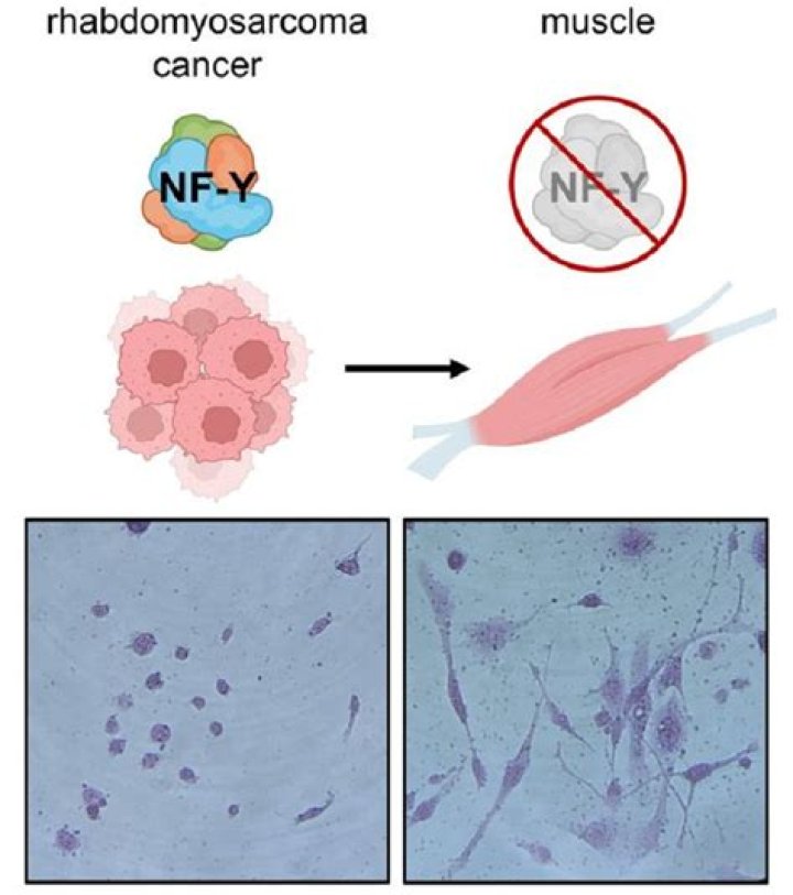 How rhabdomyosarcoma affect the body?