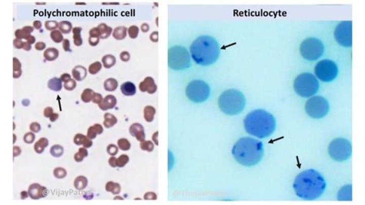How to count reticulocyte?