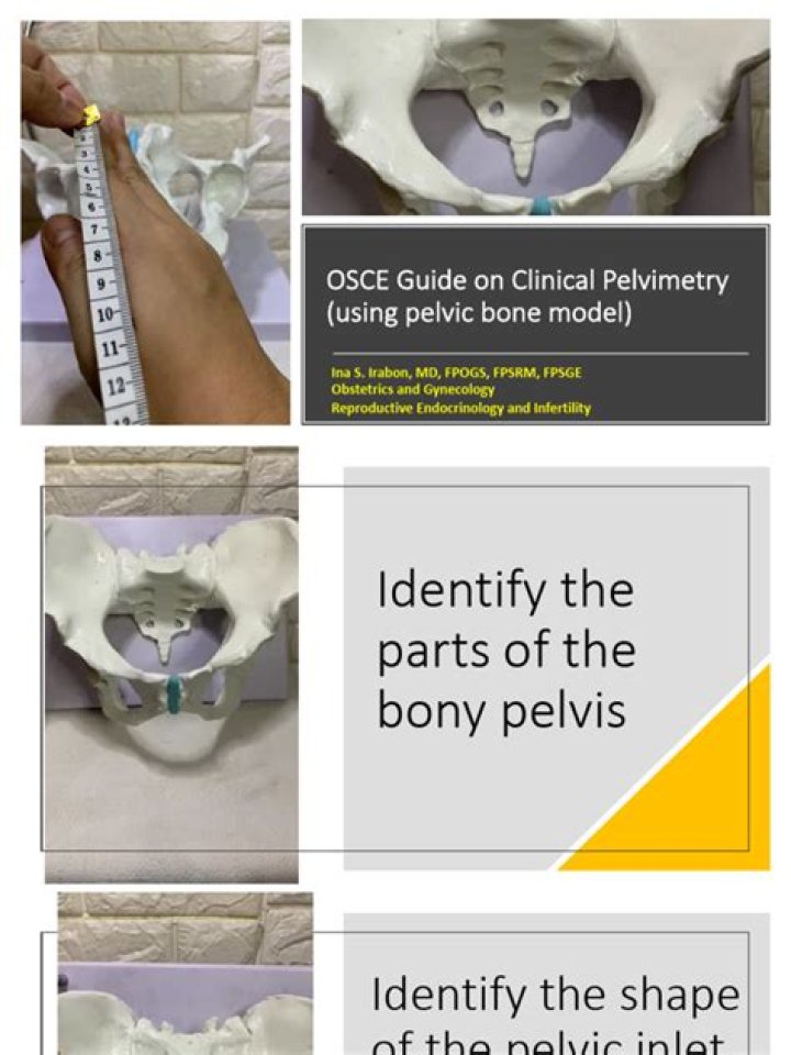 How to do clinical pelvimetry?