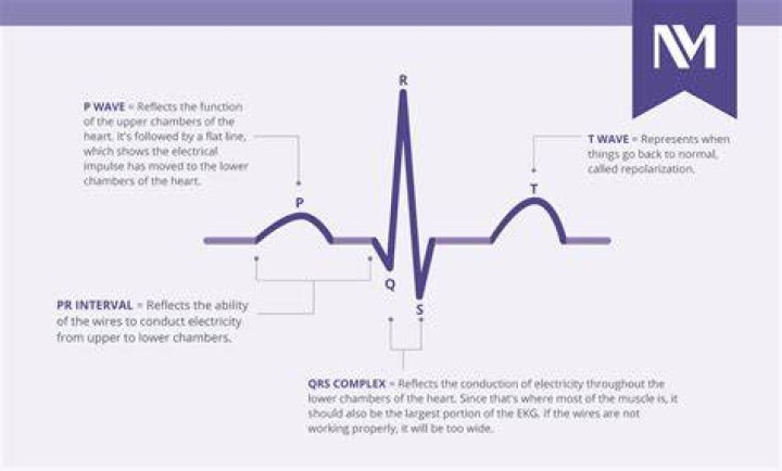 How to explain thready pulse?