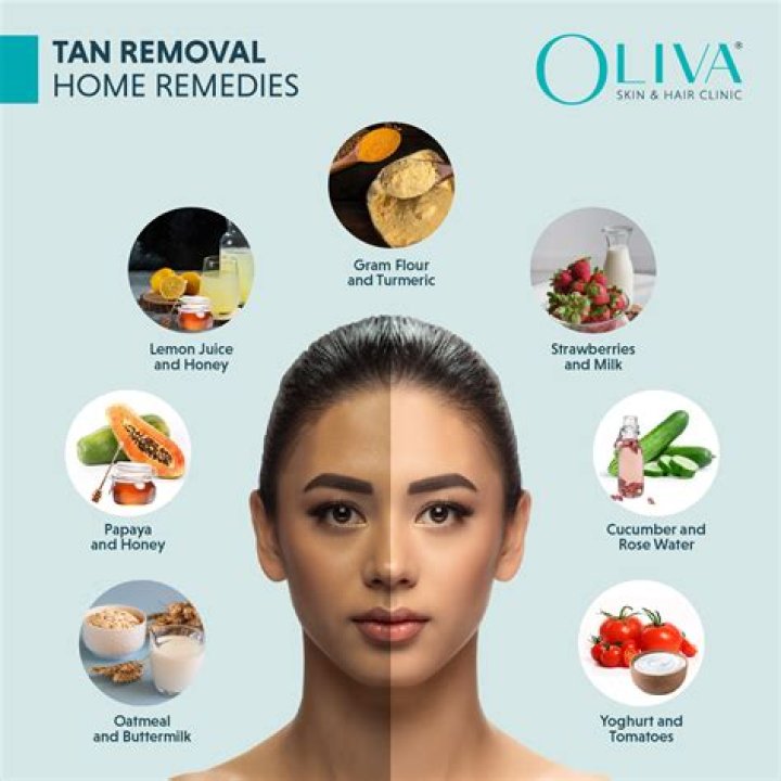 How to remove chasma naturally?