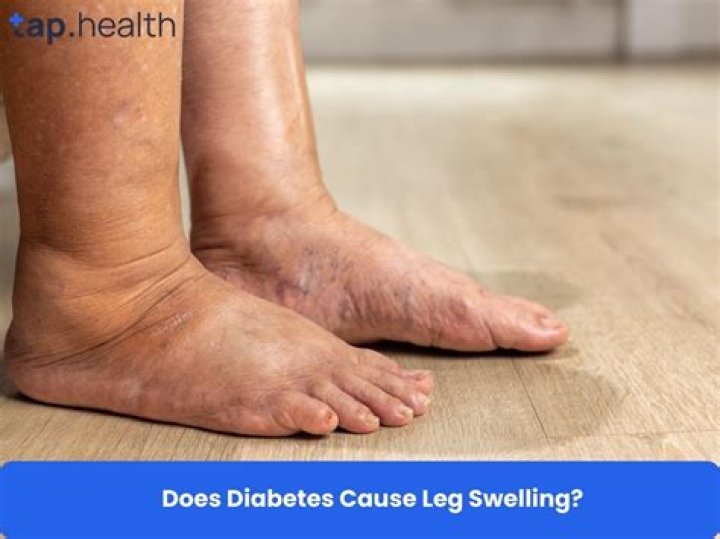 Is a diabetic coma?