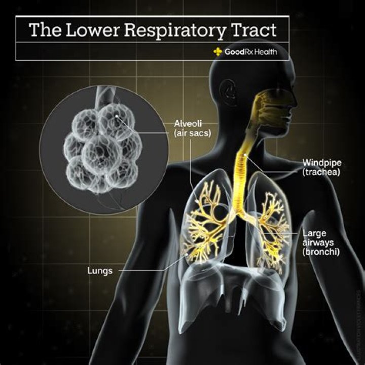 Is bronchitis contagious to others?