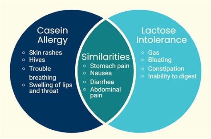 Is caseinate an allergy?