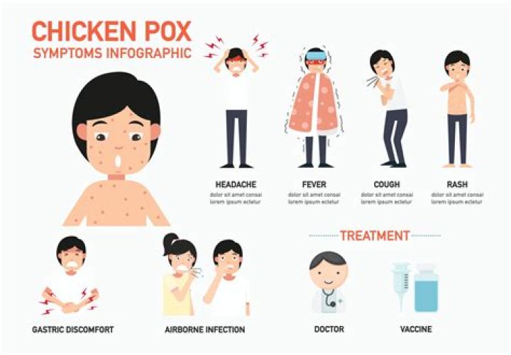 Is chicken pox catching?