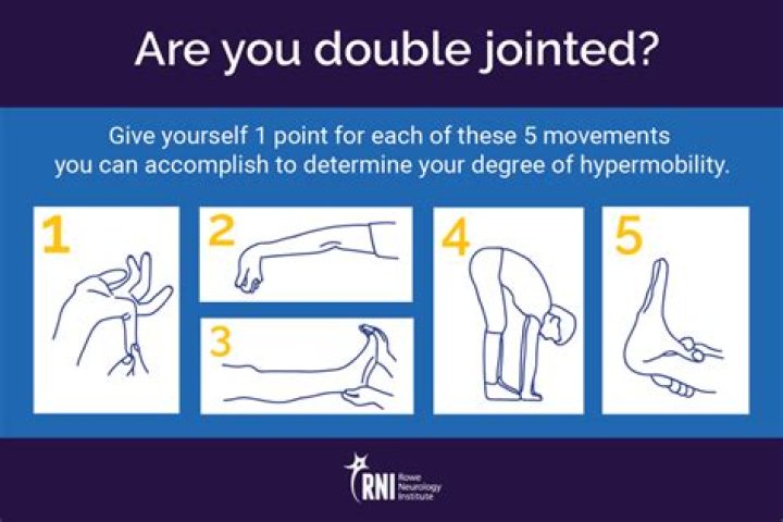 Is jointedness a word?