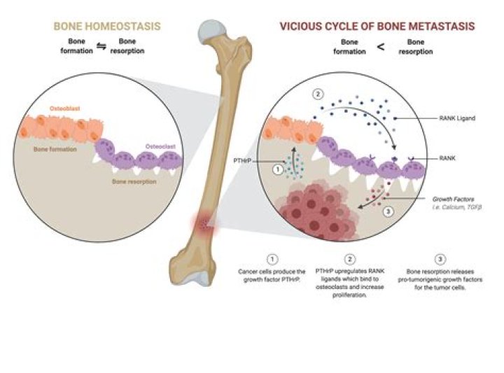 Is metastases a verb?