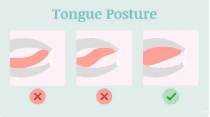 Should your teeth touch?
