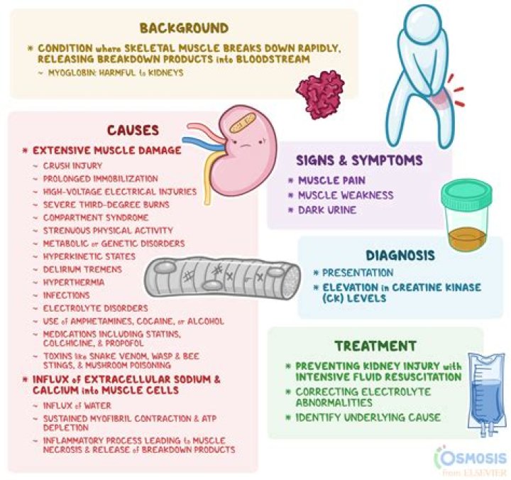 What can cause rhabdo?