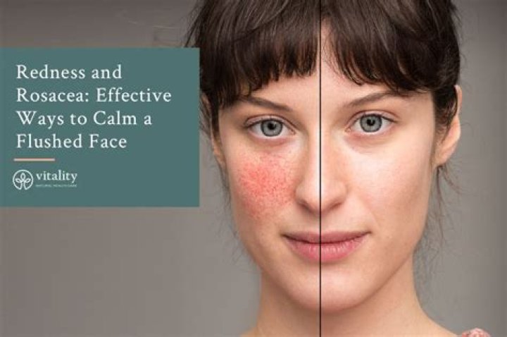 What causes flushness in the face?