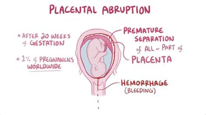 What does abnormal placenta mean?