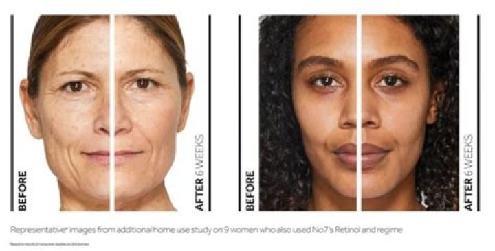 What does retinol do?