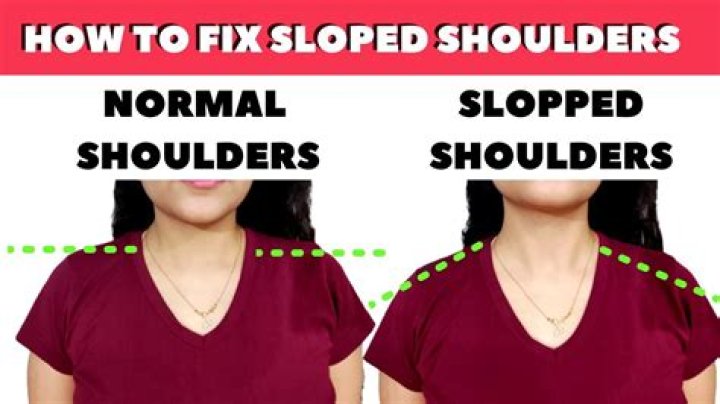 What does sloped shoulders mean?