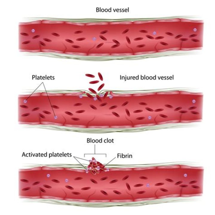 What does thromboplastin mean?
