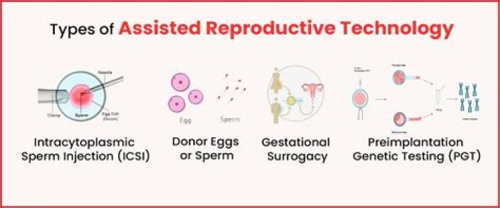 What is assisted reproductive technology?